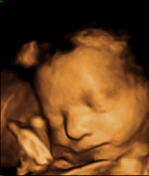 Ultrasound Pregnancy Scan Burgess Hill